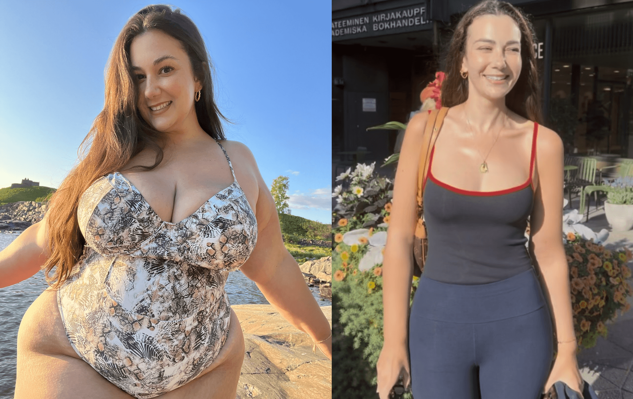 Z 137 na 59 kilogramů. Influencerka Jones ale nechala v zahraničí za operace raketu