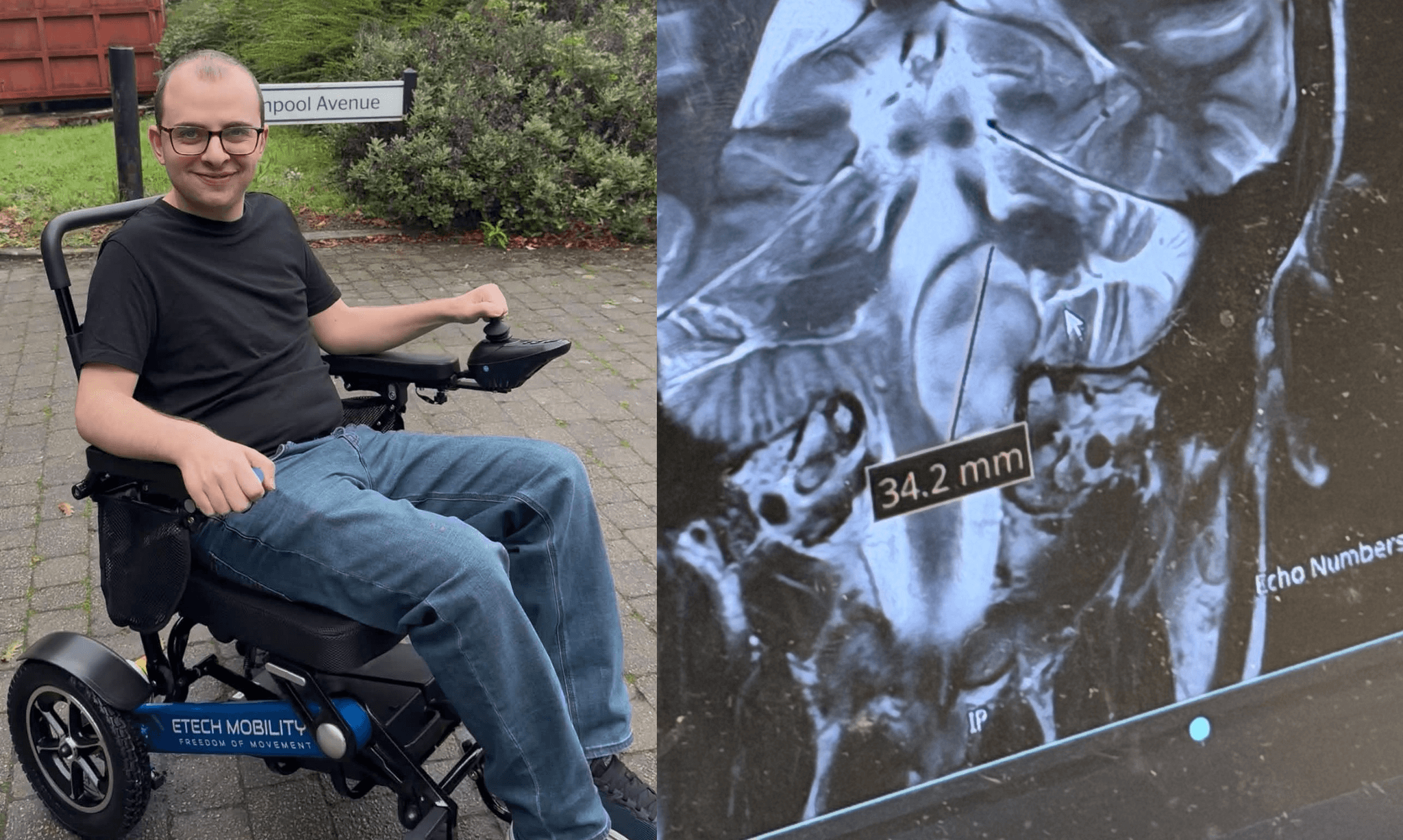 Herniman chce žít naplno, ale ne umírat pomalu. Poslanci mu odepřeli právo rozhodnout o vlastním konci